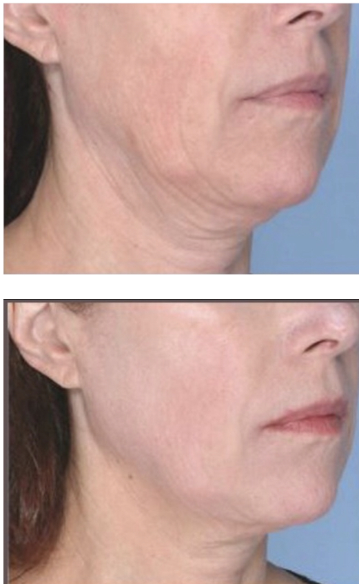 D85EC8B3-6A7A-4417-B011-04FF334DA5C6