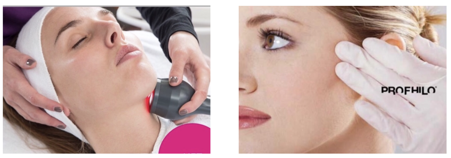 E32177A0-1159-45B0-9B20-D86F6759006A